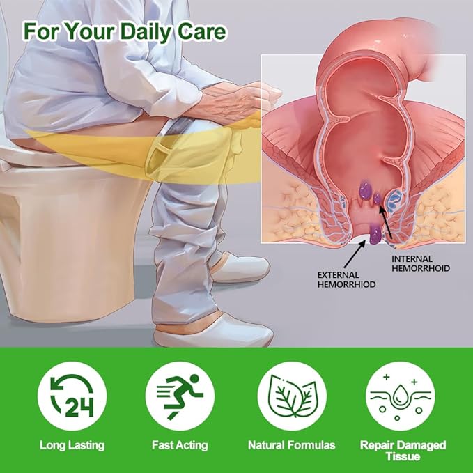 Hemorrhoids and Fissure Relief Cream,Hemorrhoid Ointment for Hemorrhoid Treatment Fast Acting Relief of Pain, Swelling