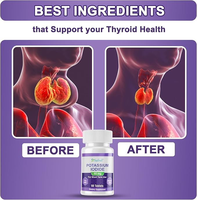 Potassium Iodide 65 mg Tablets per Serving