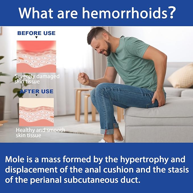 Herbal Hemorrhoid Cream, Professional Hemorrhoid Treatment Cream,Quickly take Effect to Relieve discomfort (2)