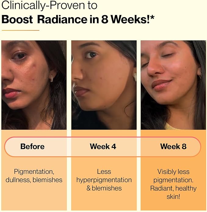 SETU Skin Renew, Glutathione with Vitamin C, Gluta Fizz, Supports Detoxification, Sugar-Free, Orange Flavour, 30 Effervescent Tablets