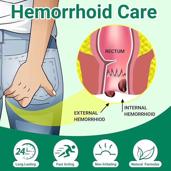 Hemorrhoid Treatment Ointment, Maximum Strength Treatment & Fast Relief for Pain, Itching, Burning, Swelling, Fissure, Bleeding, Discomfort, Long-Lasting Internal & External Hemorrhoid Cream(4-Pack)