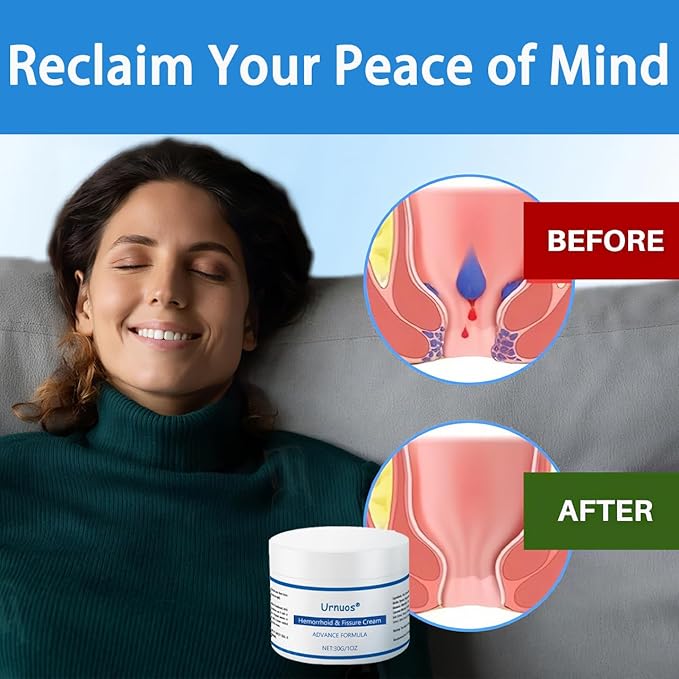 Hemorrhoid & Fissure Cream, Professional Hemorrhoid Treatment and Hemorrhoid Cream, Hemorrhoid Treatment Cream-30g, Soothing Treatment Formula (3)