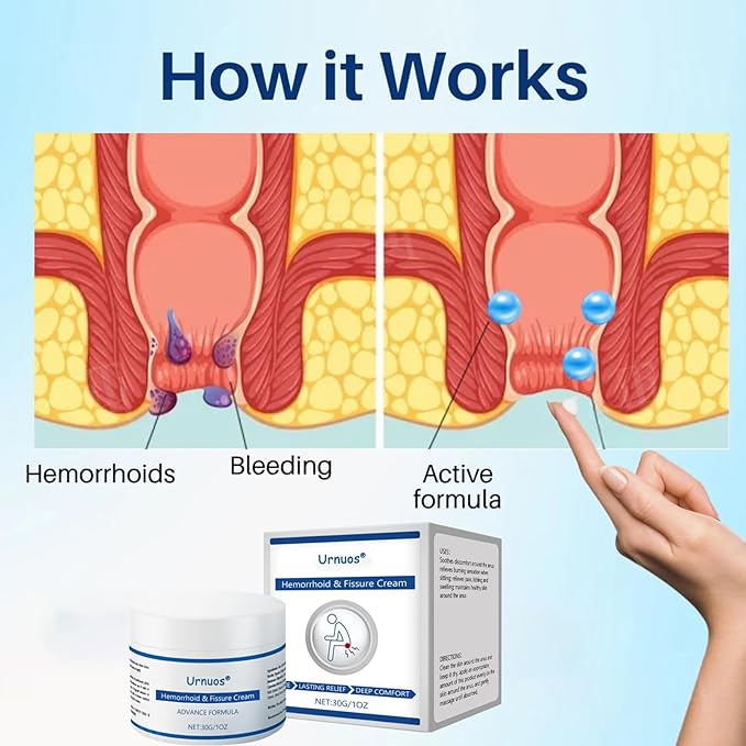 Hemorrhoid & Fissure Cream, Professional Hemorrhoid Treatment and Hemorrhoid Cream, Hemorrhoid Treatment Cream-30g, Soothing Treatment Formula (3)