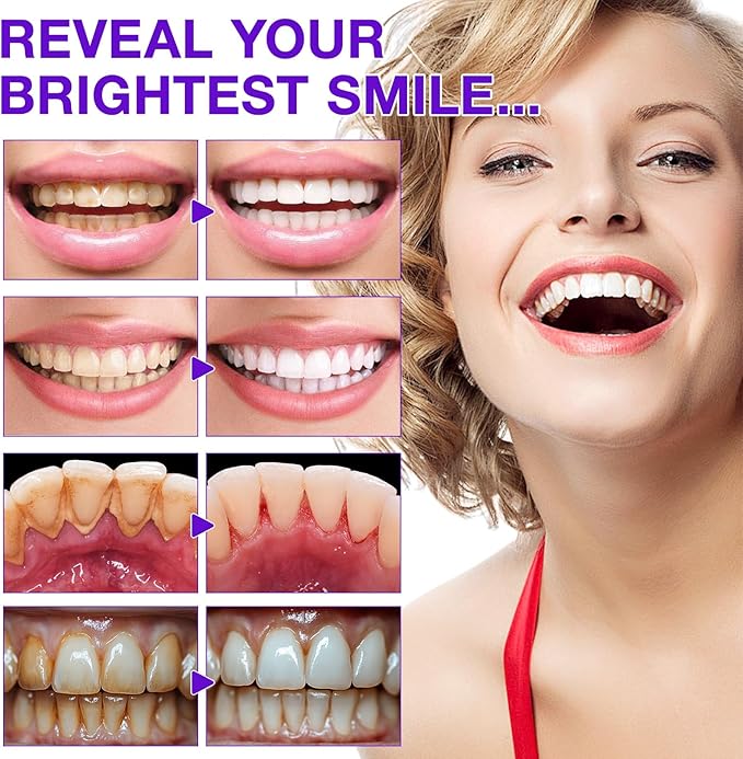 150 Pcs Purple Toothpaste Tablets with Nano Hydroxyapatite for Teeth Whitening, Fresh Breath, Enamel-Safe and Remineralizing Tablets with Coconut Oil, Peppermint, Travel Friendly