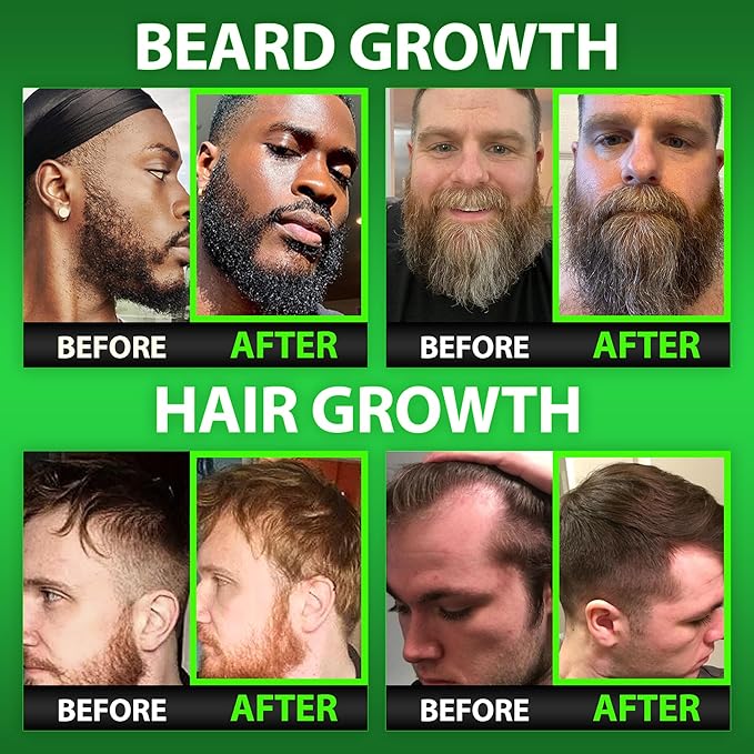 Best Beard Stuff Beard Growth Vitamins - Biotin Gummies for Beard & Hair Growth – Maximum Strength 620,000mcg Biotin with Collagen, MSM, Keratin & Bamboo Extract
